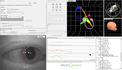 Epley Omniax software