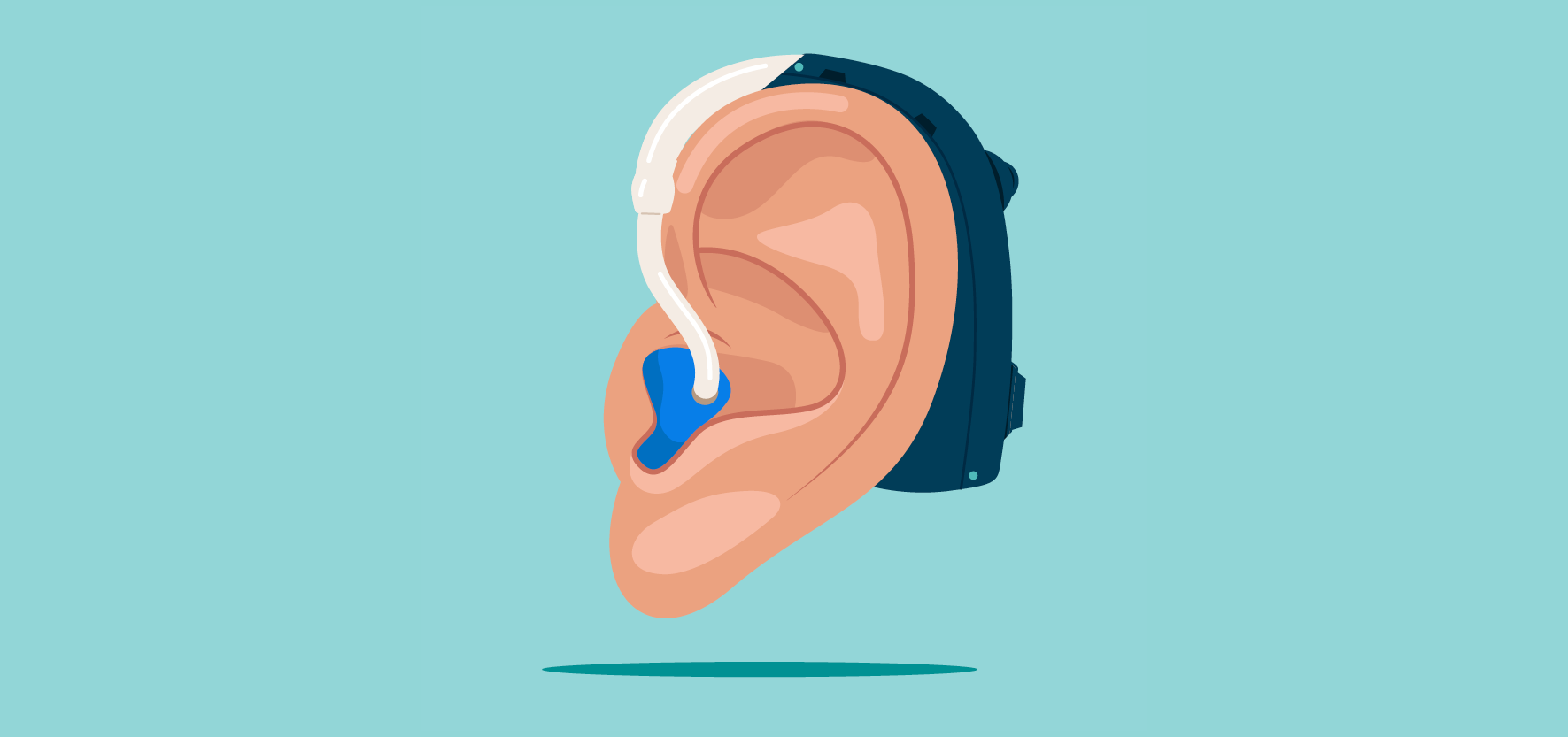 Image of an ear wearing a hearing aid
